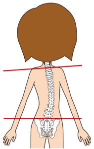 原因⑵：姿勢が悪く、左右で骨格がずれてしまっている